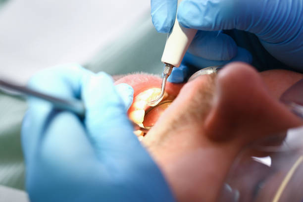 Best Holiday Emergency Dentist in Wellington, TX