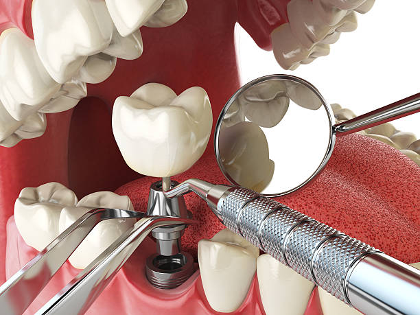 Best Broken or Cracked Tooth Emergency Dentist in Wellington, TX